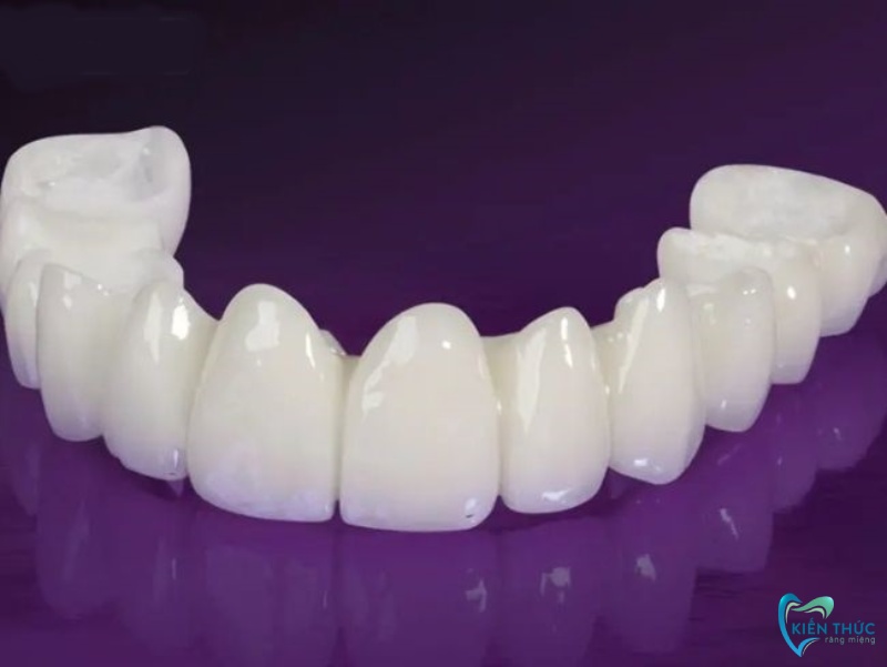 Mão răng toàn sứ có độ cứng cao và không bị nhiễm màu của thực phẩm