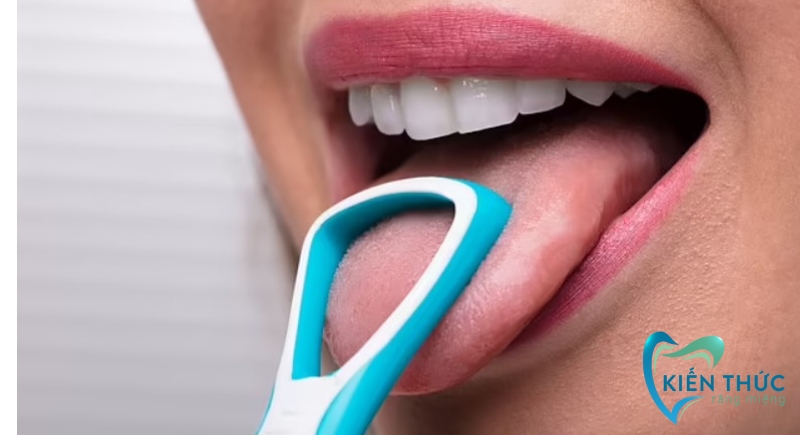 Cách phòng ngừa hôi miệng sau khi trồng răng Implant 