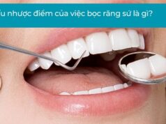 Ưu nhược điểm của việc bọc răng sứ là gì?