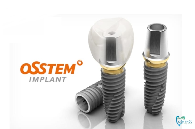 Implant Osstem là loại trụ khá phổ biến ở Hàn Quốc
