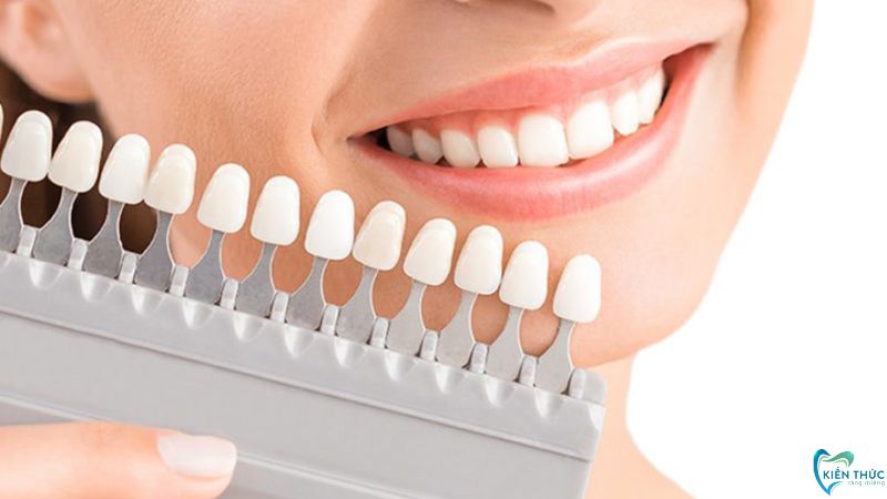 Khi bắt đầu quy trình bọc răng sứ, Cô Chú, Anh Chị cần chọn loại răng sứ phù hợp để kết quả có tỷ lệ thành công