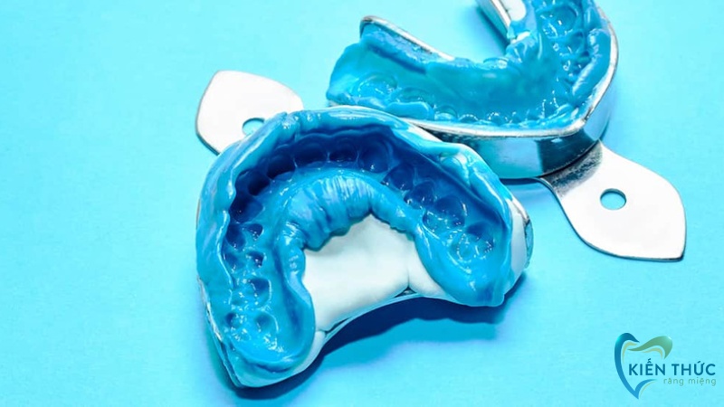 Quy trình bọc răng sứ được thực hiện như thế nào?