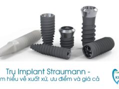 Trụ Implant Straumann - Tìm hiểu về xuất xứ, ưu điểm và giá cả