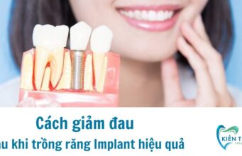 Cách giảm đau sau khi trồng răng Implant hiệu quả