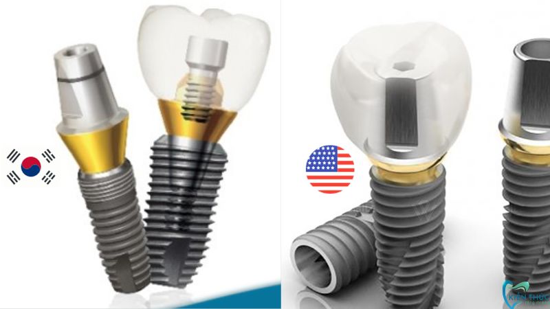 Cả 2 dòng trụ Implant Dentium Hàn Quốc và Mỹ đều thuộc danh sách những dòng trụ chất lượng tốt nhưng chi phí tầm trung