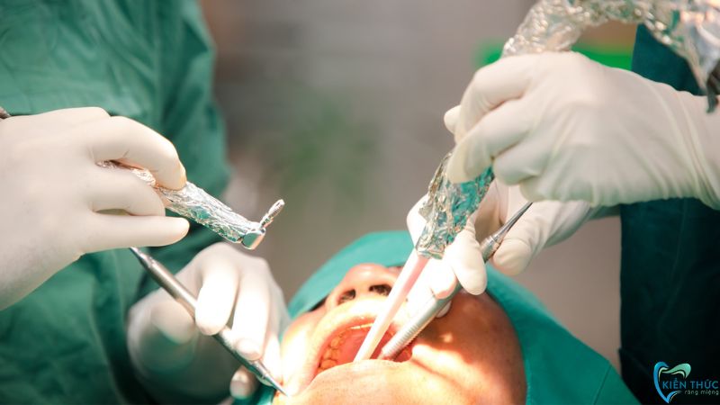 Sau khi nhổ răng số 6 cần phục hồi răng mất bằng phương pháp trồng răng Implant để ăn nhai tốt hơn