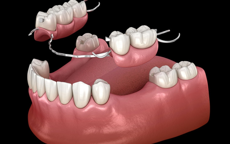 Ưu và nhược điểm của từng phương pháp